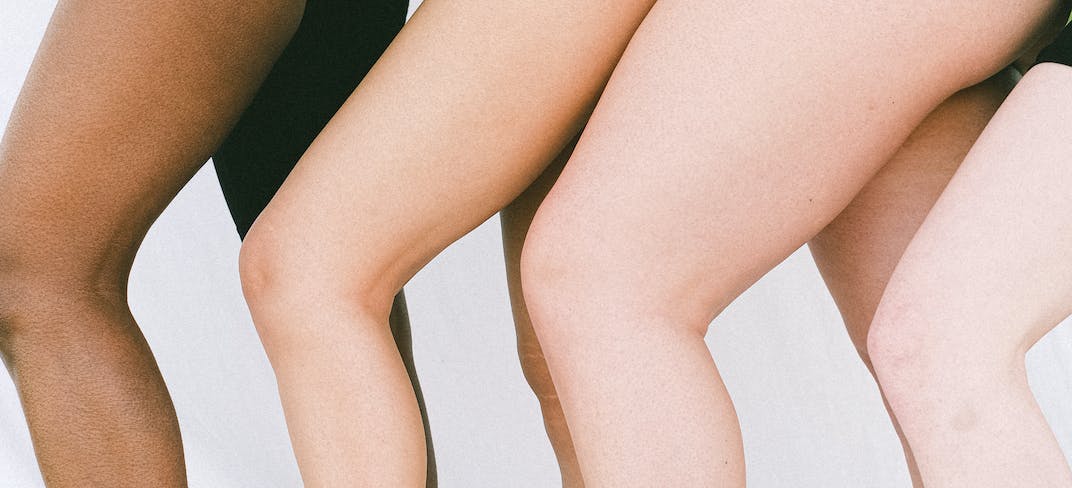 Gambe gonfie: cause e terapie. Intervista al Dott. Marco Franceschini | UPMC Italy