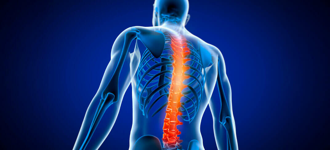 Spinal Cord Stimulation: A Promising New Treatment for SMA | UPMC Italy