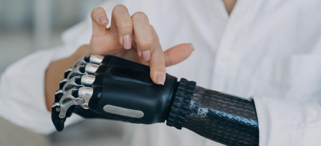 New Brain-Computer Interface for More Realistic Prosthetic Limbs | UPMC Italy